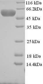 Human MYLIP protein