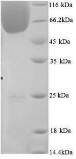 Mouse Bag3 protein