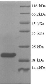 Human PLXNA1 protein