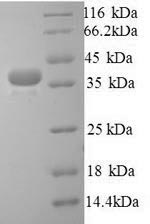 Human TLN1 protein
