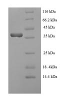 E.coli BZLF1 protein