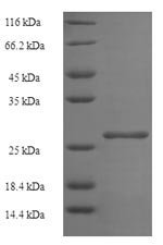Human HIST1H2BB protein
