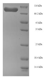 Human PGM1 protein