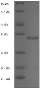 Human TXNDC12 protein
