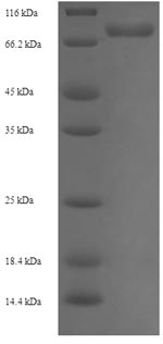 Human UGDH protein