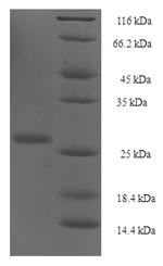 Human YPEL1 protein