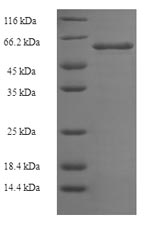 E.coli Botulinum neurotoxin type E protein