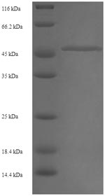 Human CASD1 protein