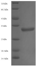 Human TGS1 protein