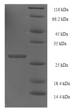 Human HIST1H2BN protein