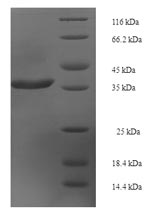 Human RABL5 protein
