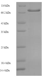 Human P4HTM protein