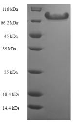 E.coli ANGPTL2 protein