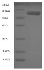 Human AHCY protein