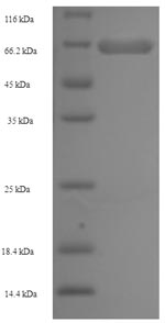 Human AP2M1 protein