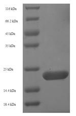 Aquaporin 4 Proteins