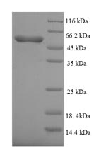 Human BMPR1A protein