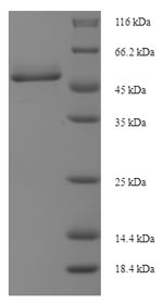 E.coli CTSD protein