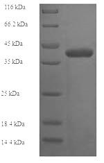 Human DNTTIP1 protein