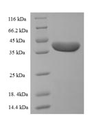 Human DSP protein
