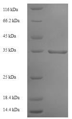Human EFNA1 protein
