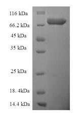 Human EPHX2 protein