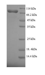 Human FANCC protein