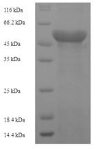 Human FBXL18 protein