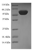Human FCGRT protein