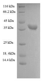 Human HNRNPA1 protein