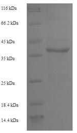 Human IL2 protein