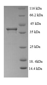 Human KIAA0101 protein