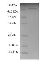 Human KRT8 protein