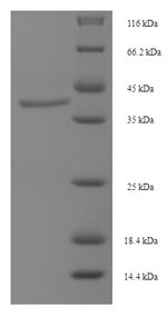 Human LHCGR protein