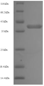 Human NAPSA protein