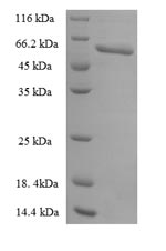 Human PLAUR protein