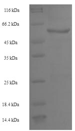 Human PTPRB protein