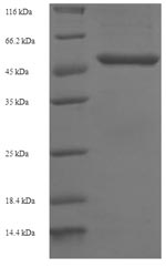 Human QPCT protein