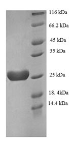 Human RCVRN protein
