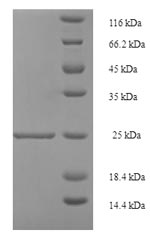 Human RETN protein