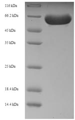 Human RIPK2 protein