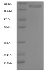 Human RRM1 protein