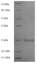 Human SDF2 protein