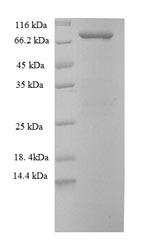 Human STIP1 protein