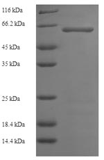 Human STK25 protein