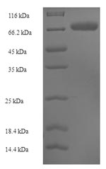 Human SUOX protein