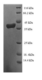 Human TCEB1 protein