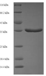 Sheep TGFA protein