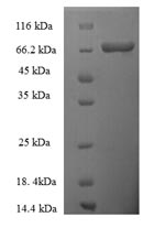 Human THRB protein
