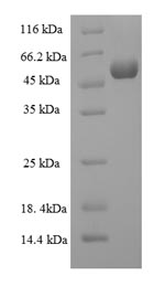 Human TPST2 protein